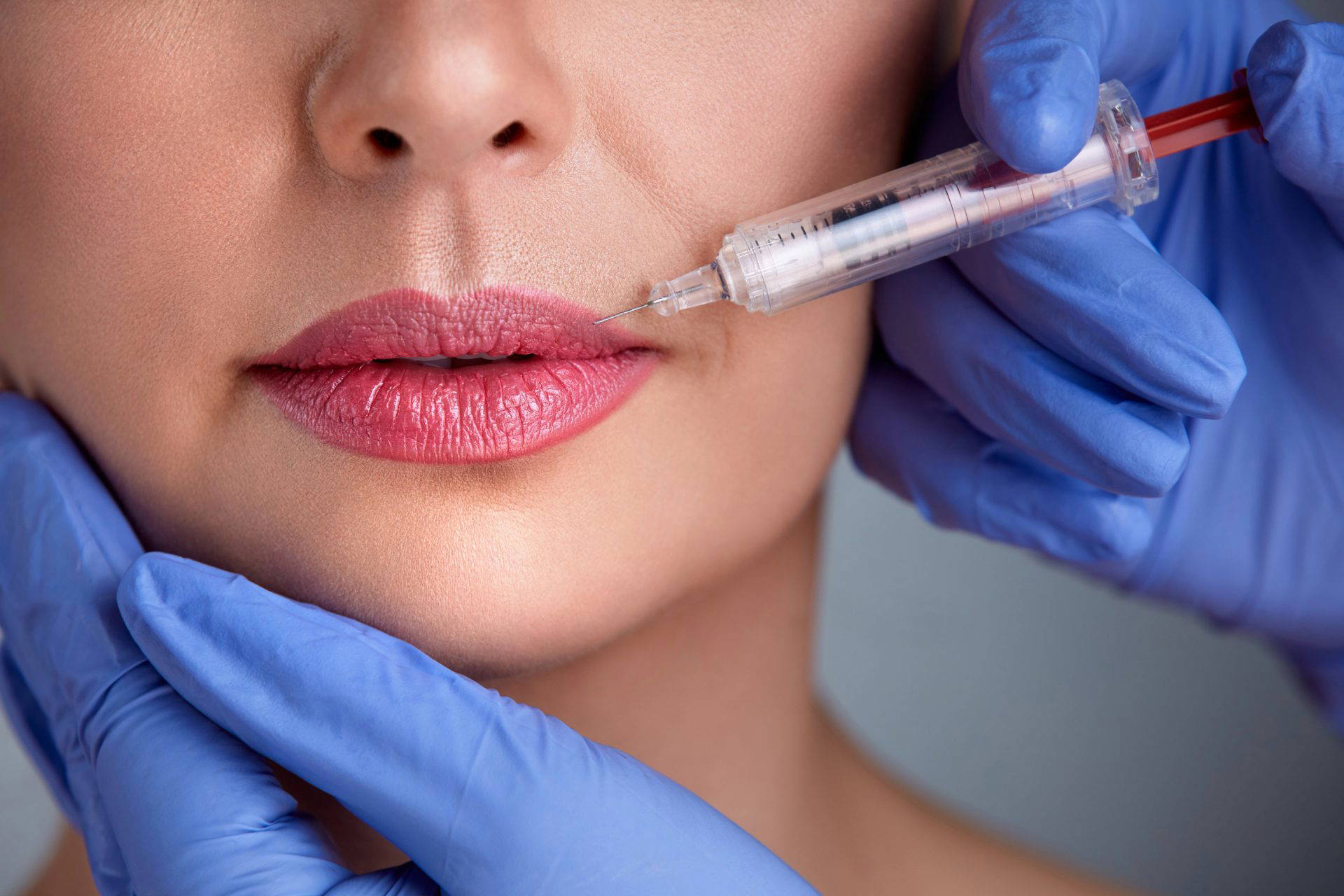 Practitioner administering a dermal filler lip injection