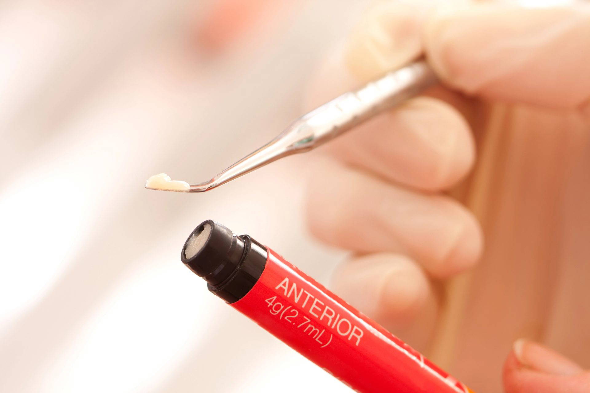 Dentist applying a composite filling to a patient's tooth