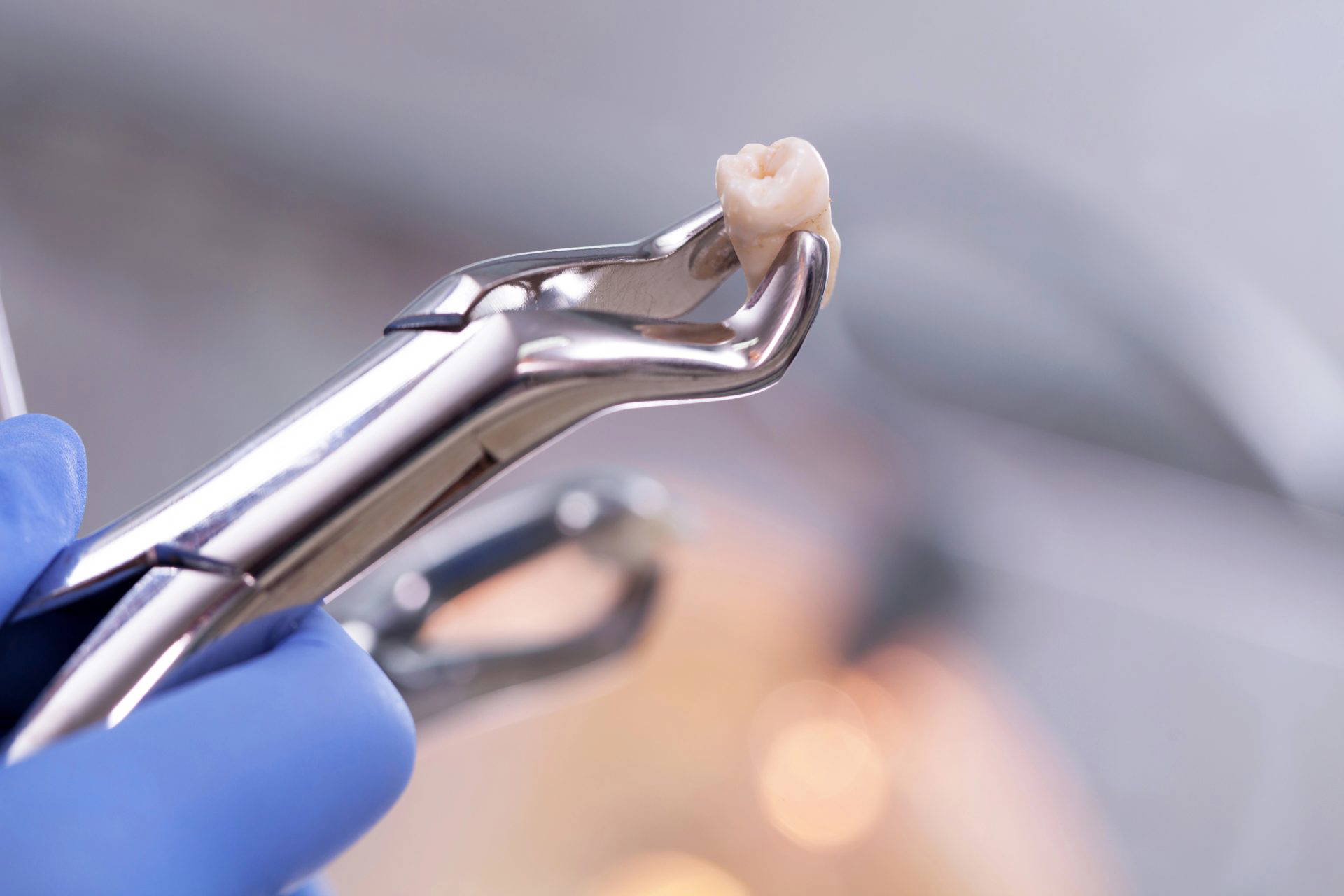 Close-up of dental extraction forceps holding a removed tooth