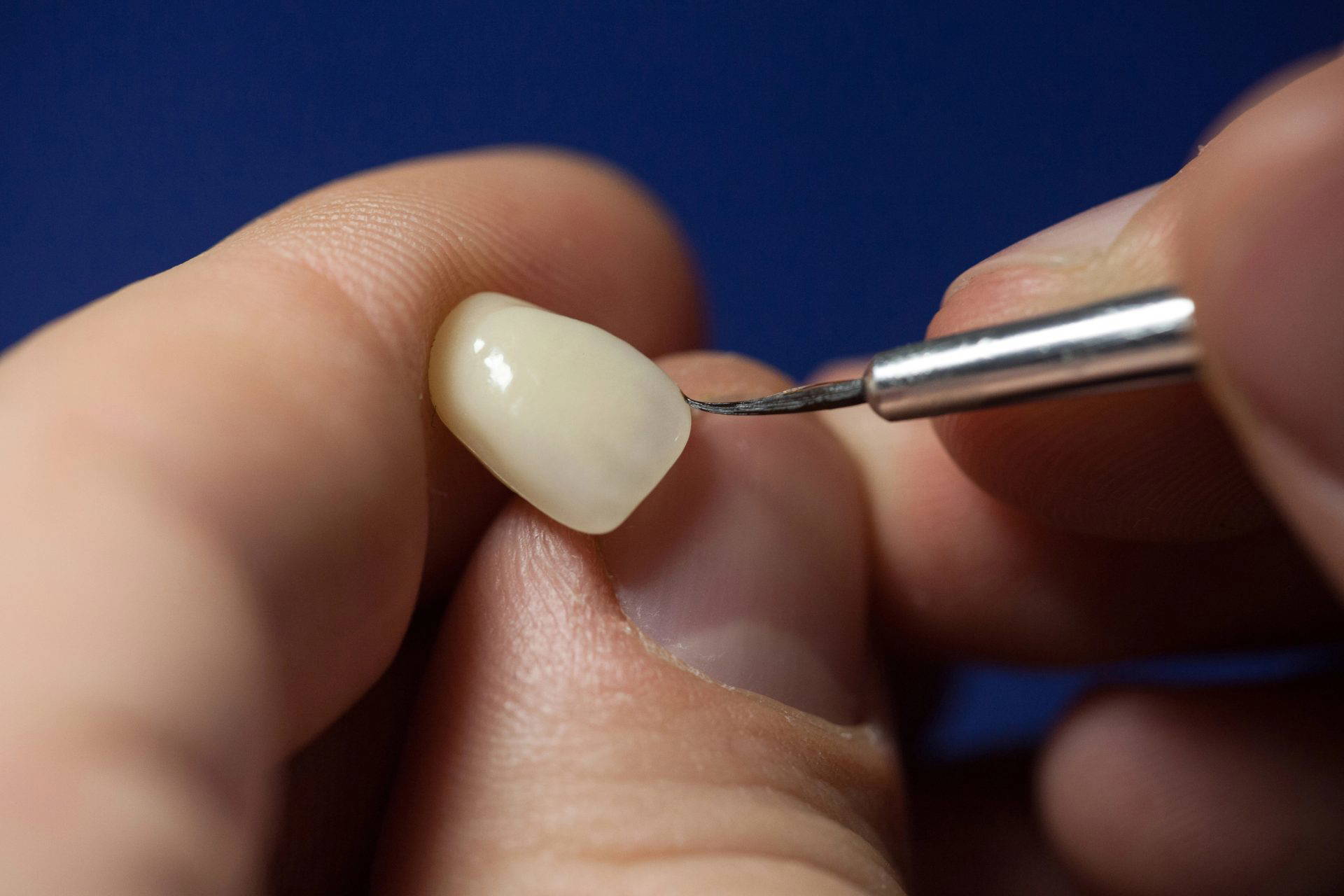 The process of someone creating a dental crown
