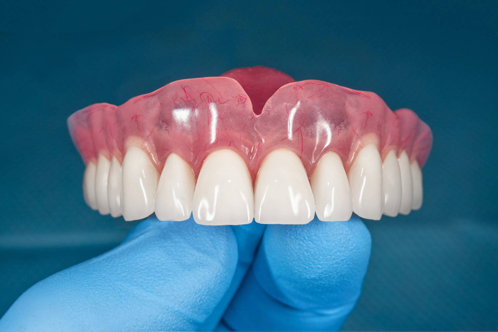 Full set of dentures on a blue background