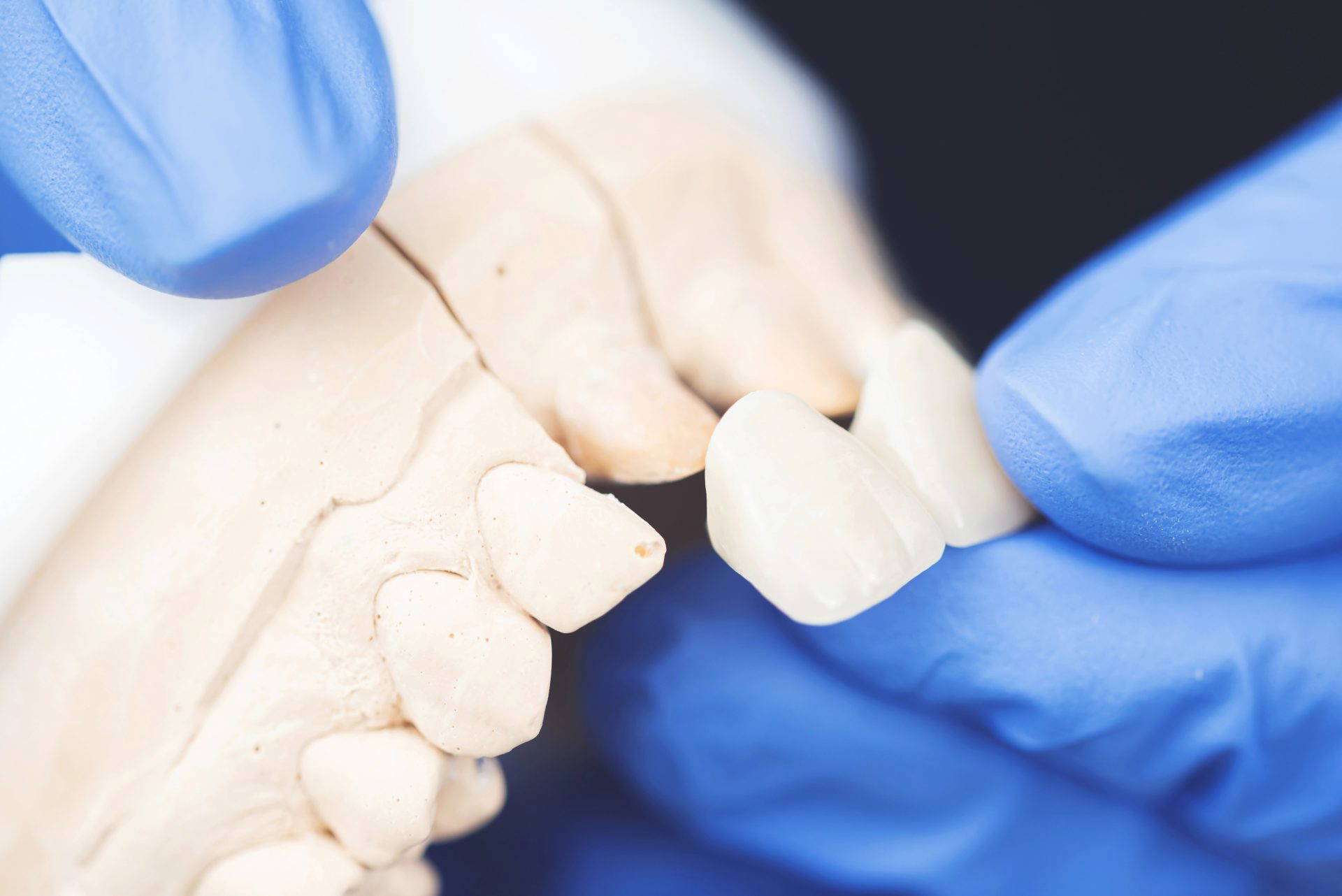 Dentist using tools to fit a dental bridge in a patient's mouth