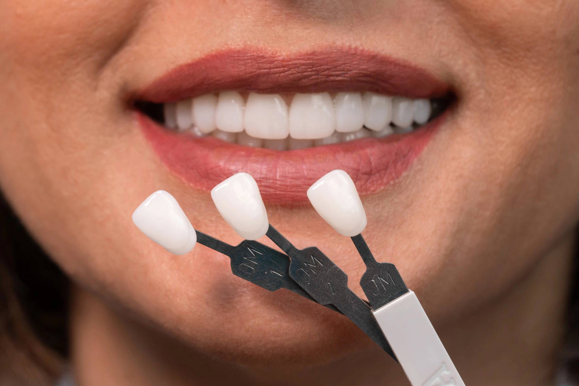 An image of a woman's smile being compared with different veneer colours.