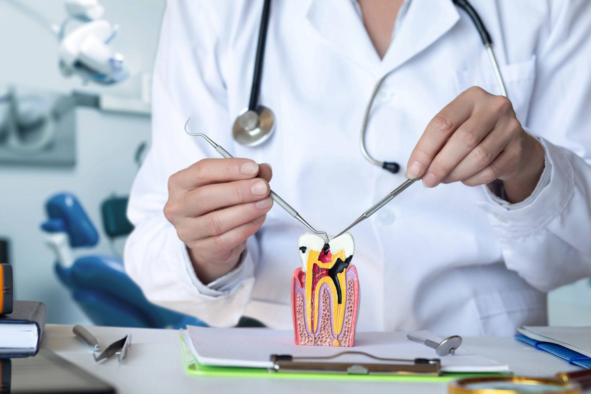 Illustrated diagram showing a root canal treatment procedure
