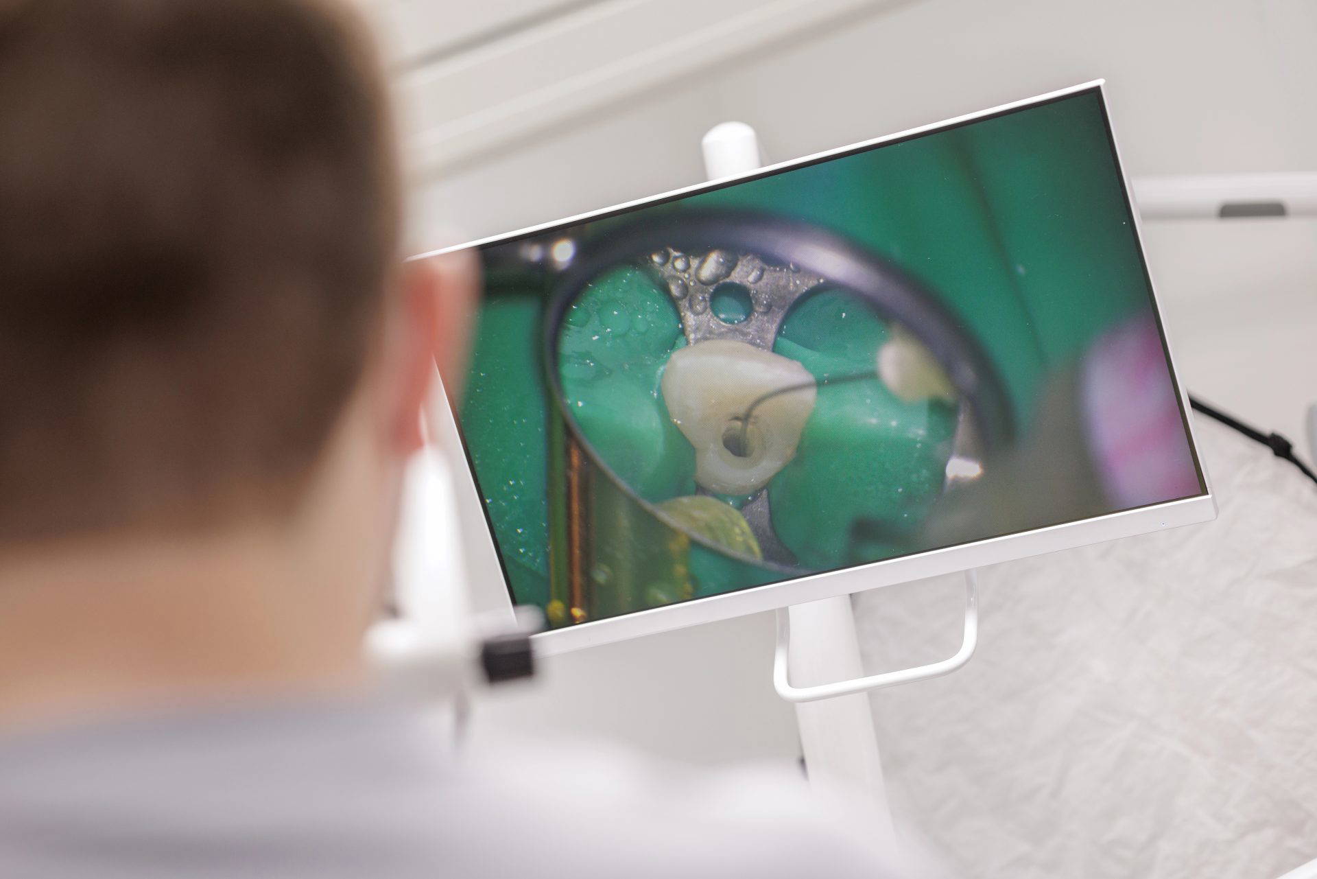 Endodontic tools used during a root canal treatment on a model tooth